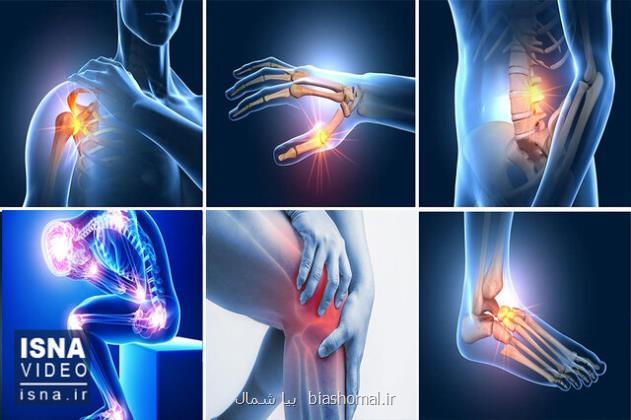 ویدیو، آرتروز میهمان همیشگی فرد مبتلا